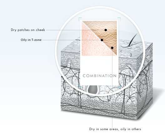 Combination Skin
