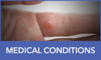Medical Conditions Medical Conditions