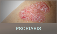 Psoriasis