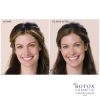 Botox Before And After San Antonio Texas