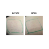 MicroPen before and after