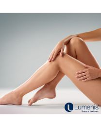 Spider Vein Laser Therapy