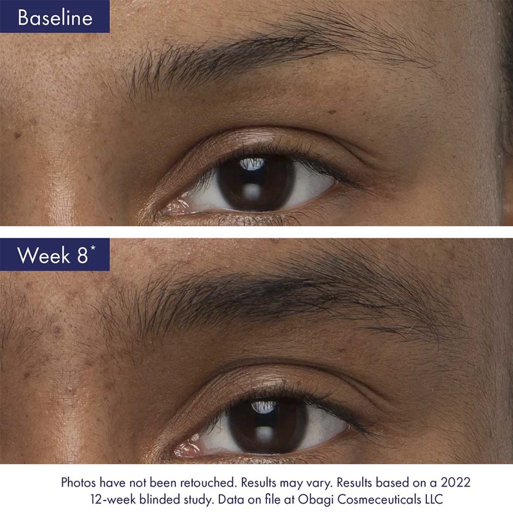 Obagi Nu-Cil™ Eyebrow Boosting Serum | Best Medical Spa