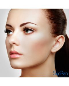 SkinPen® Micro Therapy (6 Options)