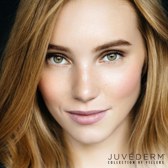 JUVÉDERM® Ultra Plus XC