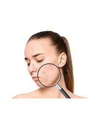 ACNE PROGRAM