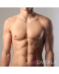 Laser Hair Removal Package - Body Areas