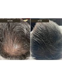Before & After 4 Months 