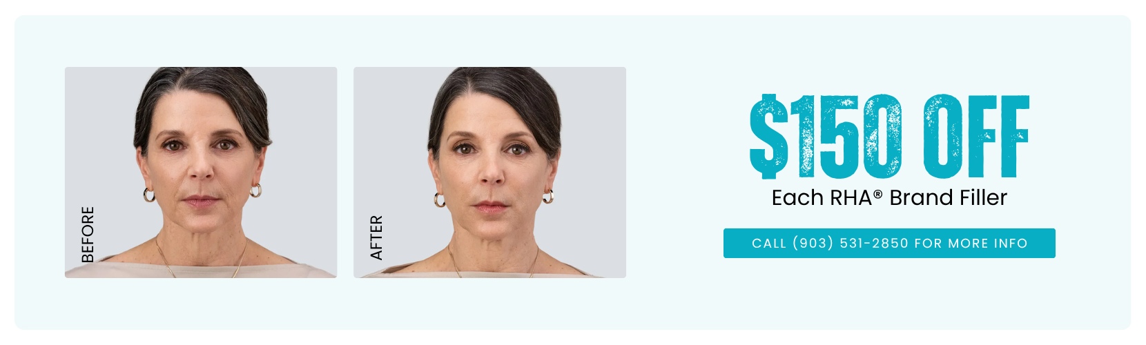 $150 OFF Each RHA® Brand Filler