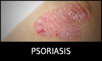 Psoriasis